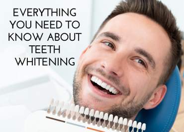 Everything You Need to Know About Teeth Whitening