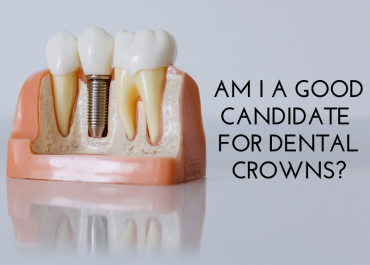 Am I A Good Candidate For Dental Crowns?
